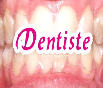 image de dent